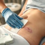 opatrunek włókninowy